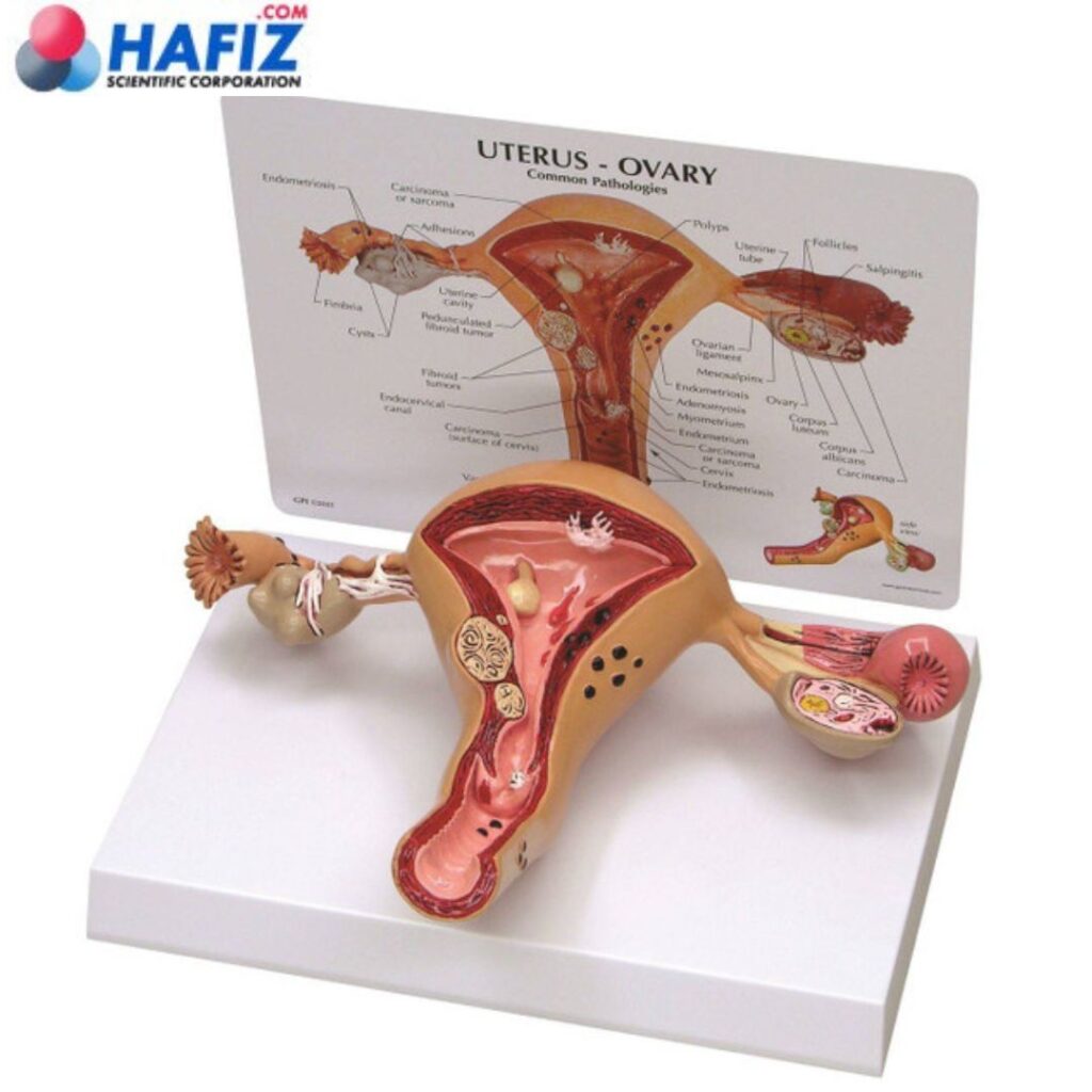 Human Uterus Model 3D Uterus Ovary Model Human Body Anatomy