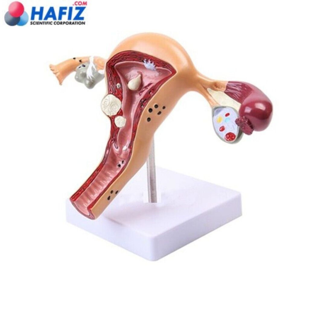 Human Uterus Model | 3D Uterus and Ovary Model