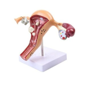 Human Uterus Model 3D Uterus Ovary Model Human Body Anatomy